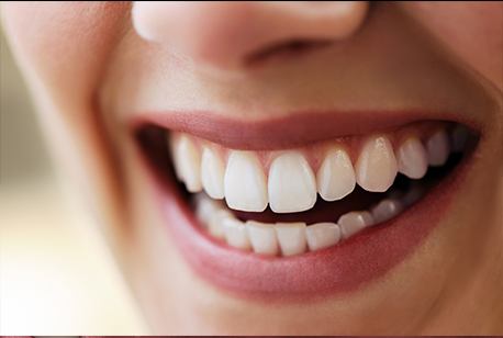 Closeup of flawless smile after full-mouth reconstruction