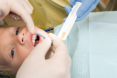 Child receiving fluoride treatment