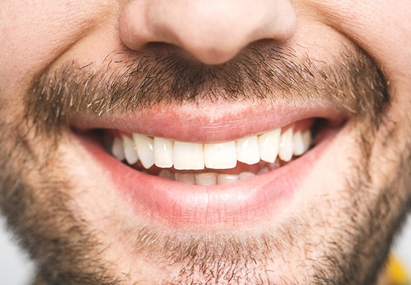 Close up of man’s smile after seeing cosmetic dentist in Loveland