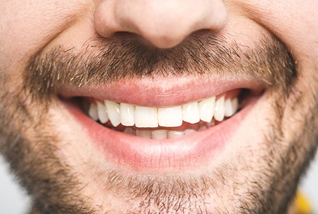 Close up of man’s smile after seeing cosmetic dentist in Loveland