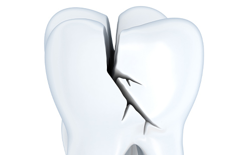 Animated tooth with crack in enamel