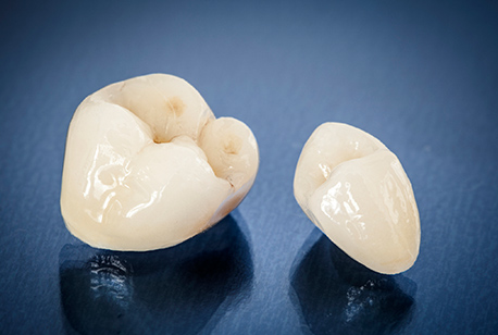 Two dental crowns prior to placement