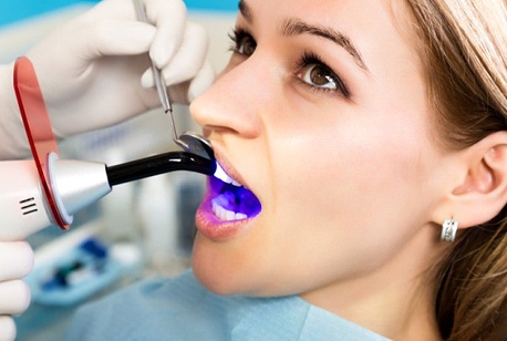 woman getting her dental bonding hardened with UV light