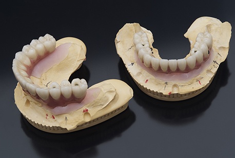 Model smile with dentures in place