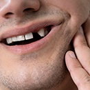 man smiling with missing tooth 