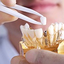 dentist placing a dental crown on top of a dental implant model