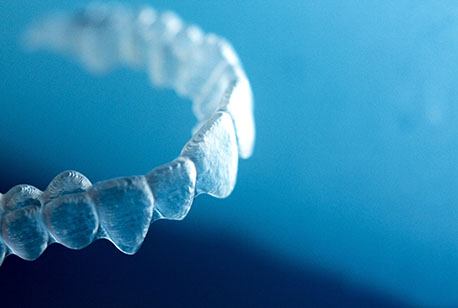 An up-close look at an Invisalign aligner designed to straighten teeth