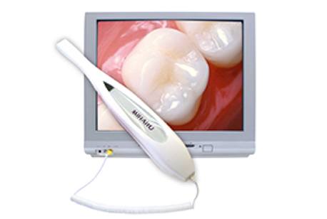 Intraoral images of teeth on computer screen