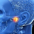 Working on a model of the jaw for TMJ treatment in Loveland, OH