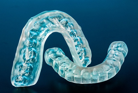 Two clear occlusal splints for TMJ treatment in Loveland, OH