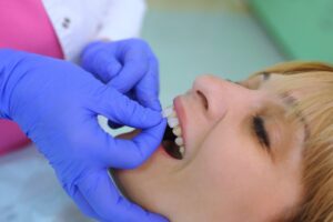 Dentist applying veneers to patient's teeth. 