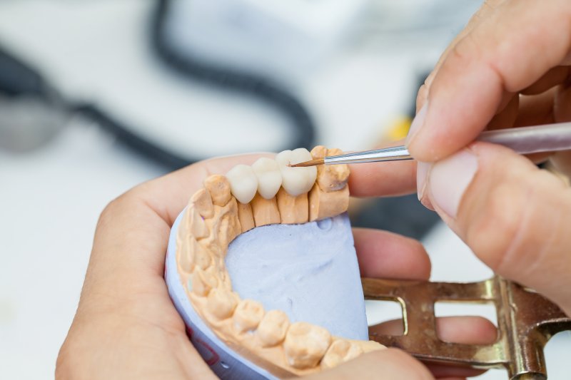 Dental tech working on a bridge for missing teeth